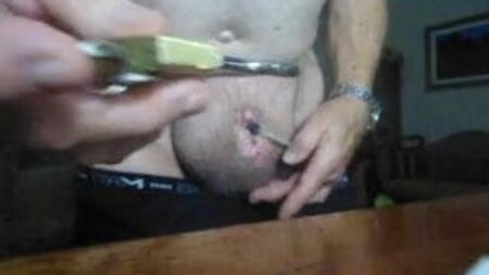 Katheter Spielerei und Penektomie mit einem grossen Schloss