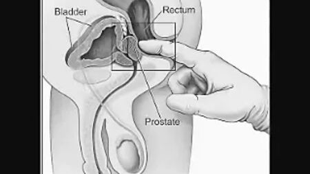 How To Milk Your Prostate By Yourself