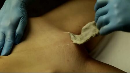 Шугаринг. Глубокое бикини.